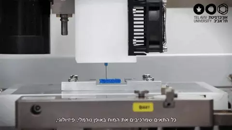 הדפסת תלת-מימד של גידול סרטני מסוג גליובלסטומה