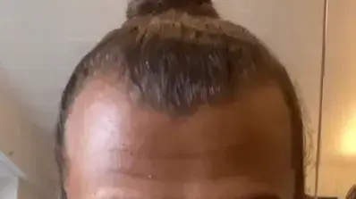 סטרומאה הזמר הבלגי