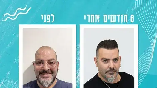 Full Hair Medical