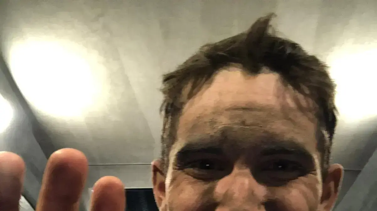הרוכב הישראלי גיא ניב מראה את הפציעות והחבורות אחרי הקטע החמישי בטור דה פראנס