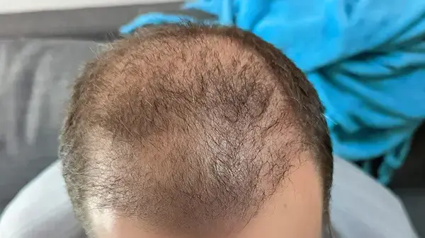 אחרי הטיפול במרפאת ד"ר אלמן