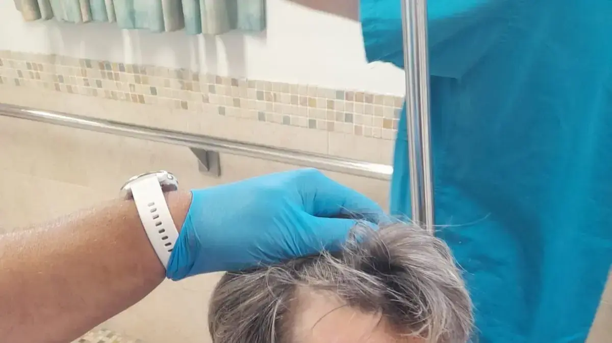 הסייעת שהותקפה על ידי מטופל בבית החולים רמב"ם 03 באוגוסט 2022