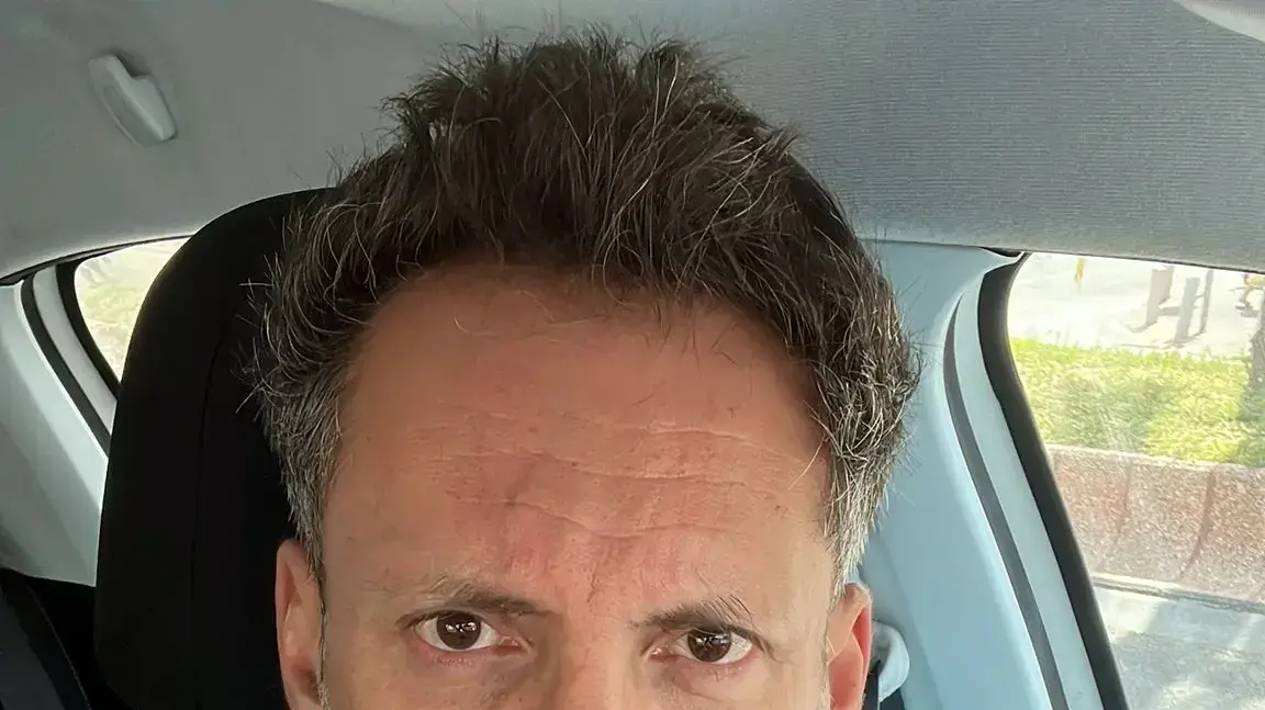 ד"ר אייל חשביה, מנהל בכיר במערך הטראומה והכירורגיה הדחופה, בית חולים איכילוב