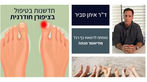 חדשנות בטיפול בציפורן חודרנית. מציג ד"ר איתן סביר