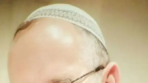 הרב עזרא שיינברג