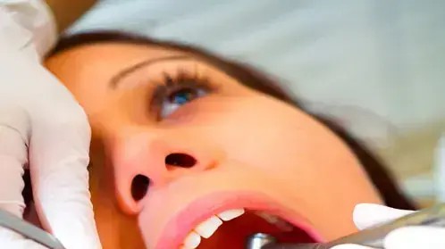 אילוסטרציה