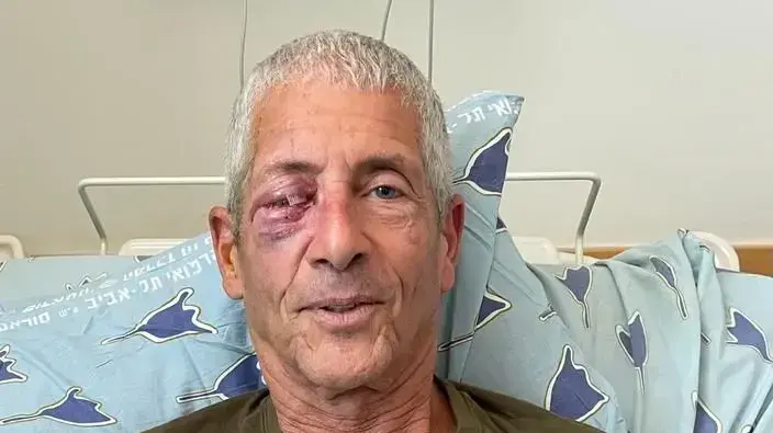 אודי אורי, המפגין שנפגע ממכתזית בעינו