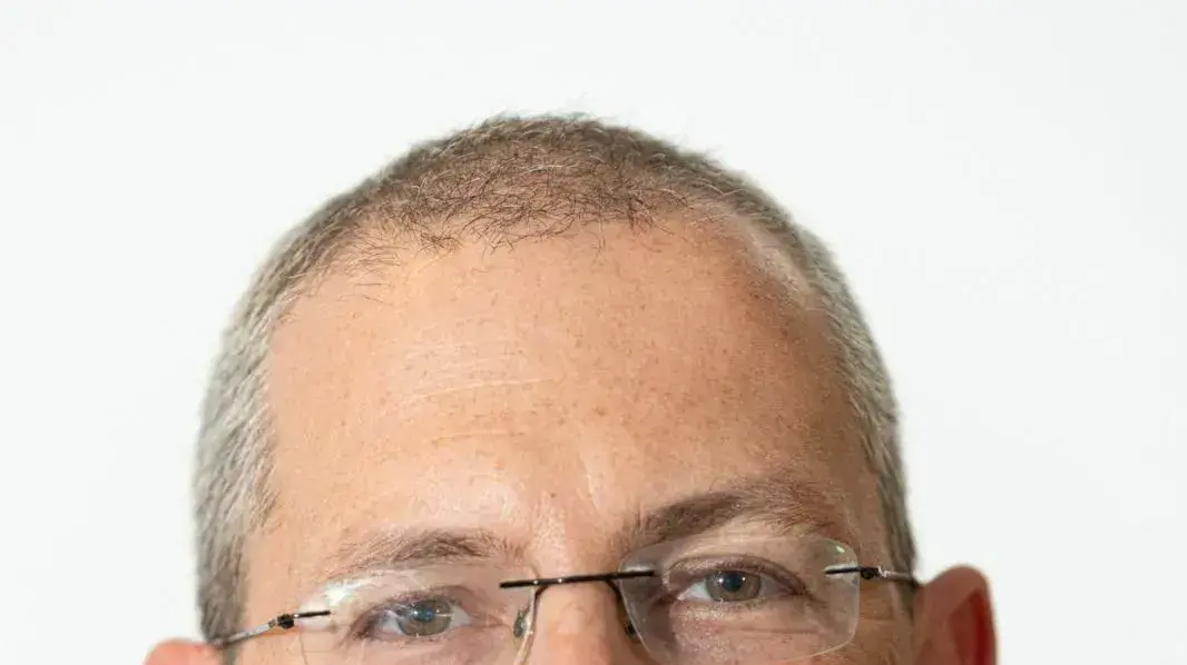 שי אהרונוביץ