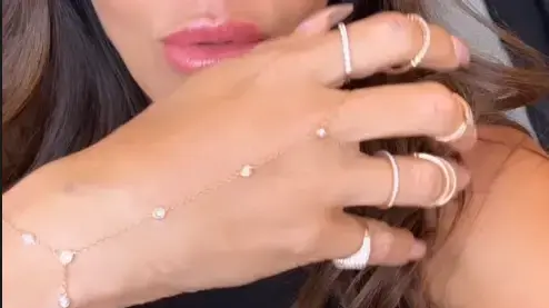 היד של נעמה קסרי אחרי הזרקה