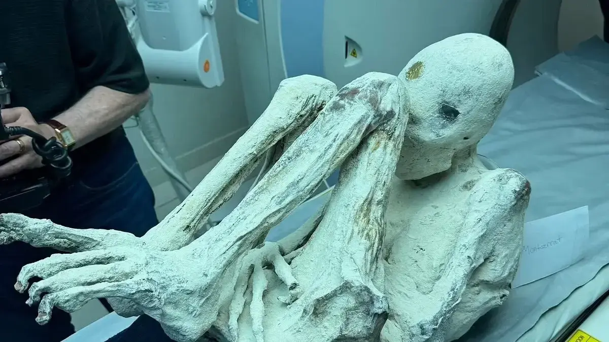 בדיקה של אחת מ"מומיות החייזרים" ב-MRI