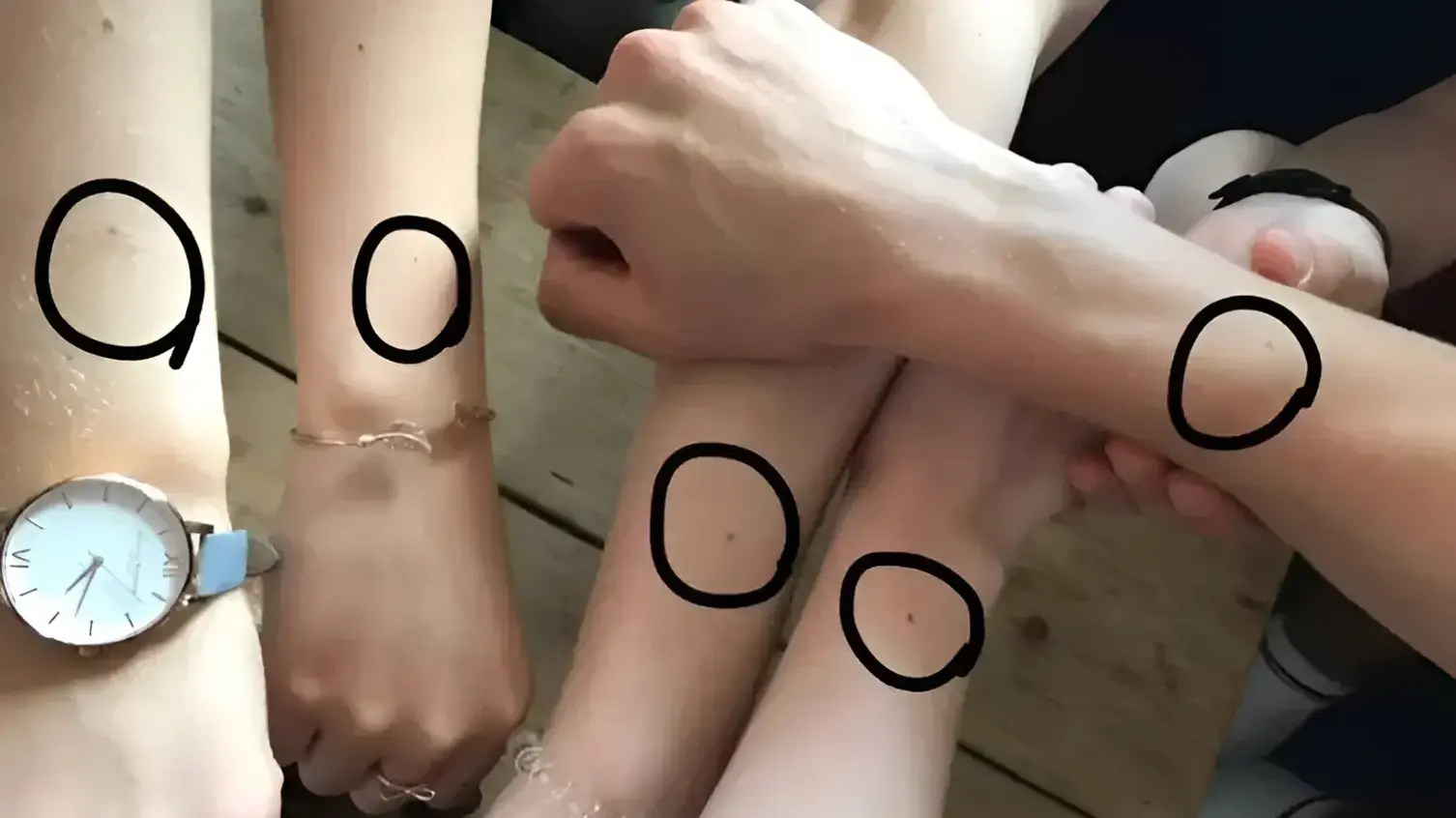 נשים עם נמש על גב היד
