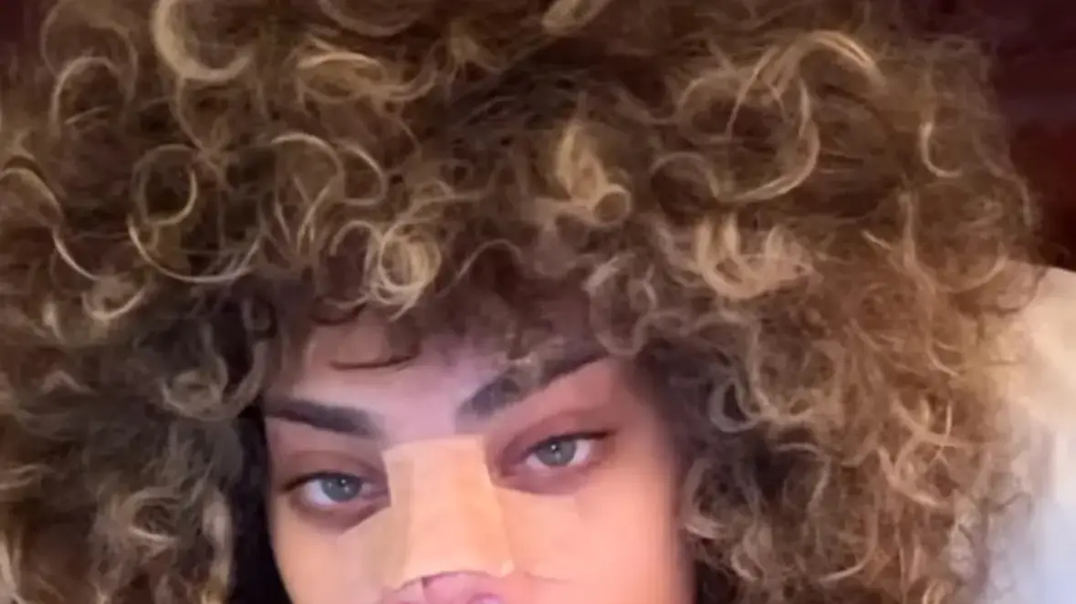 רומי אברג'יל מספרת על הניתוח הראשון