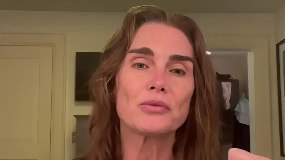 מה קרה לפנים של כוכבת העל שהייתה האישה היפה בעולם?