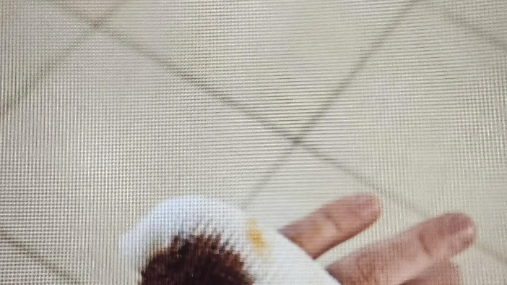 פצע הדקירה של רופא בידו , אשר נדקר על ידי נטע לי מור ,מרפאת השיניים "מכבידנט" בבני ברק, 3 לינואר 2025