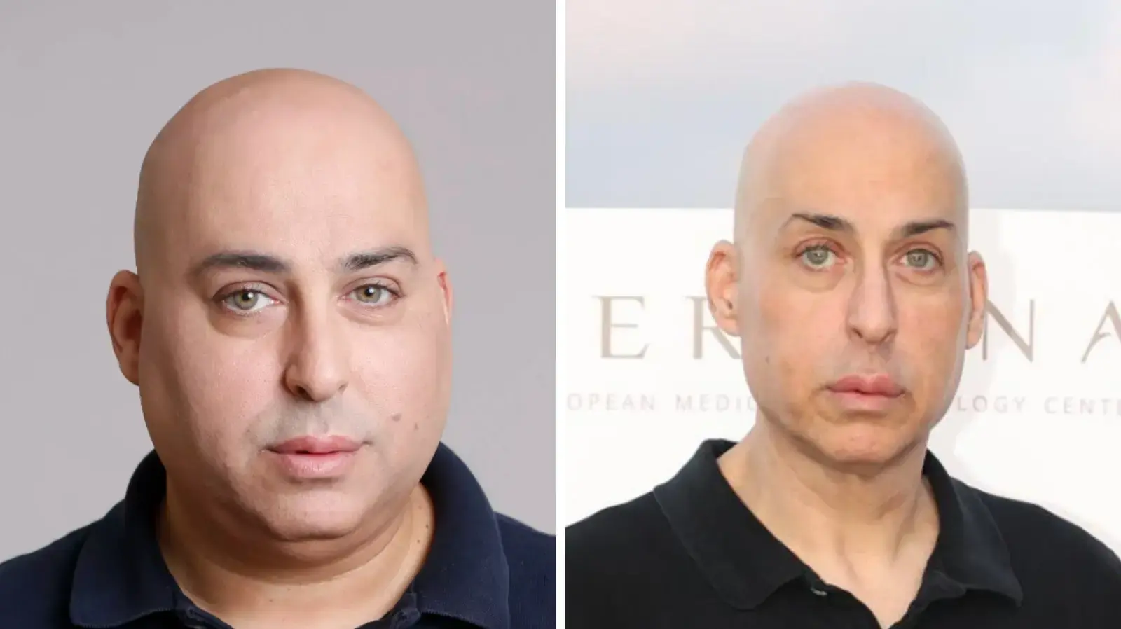 המהפך של מיקיאגי