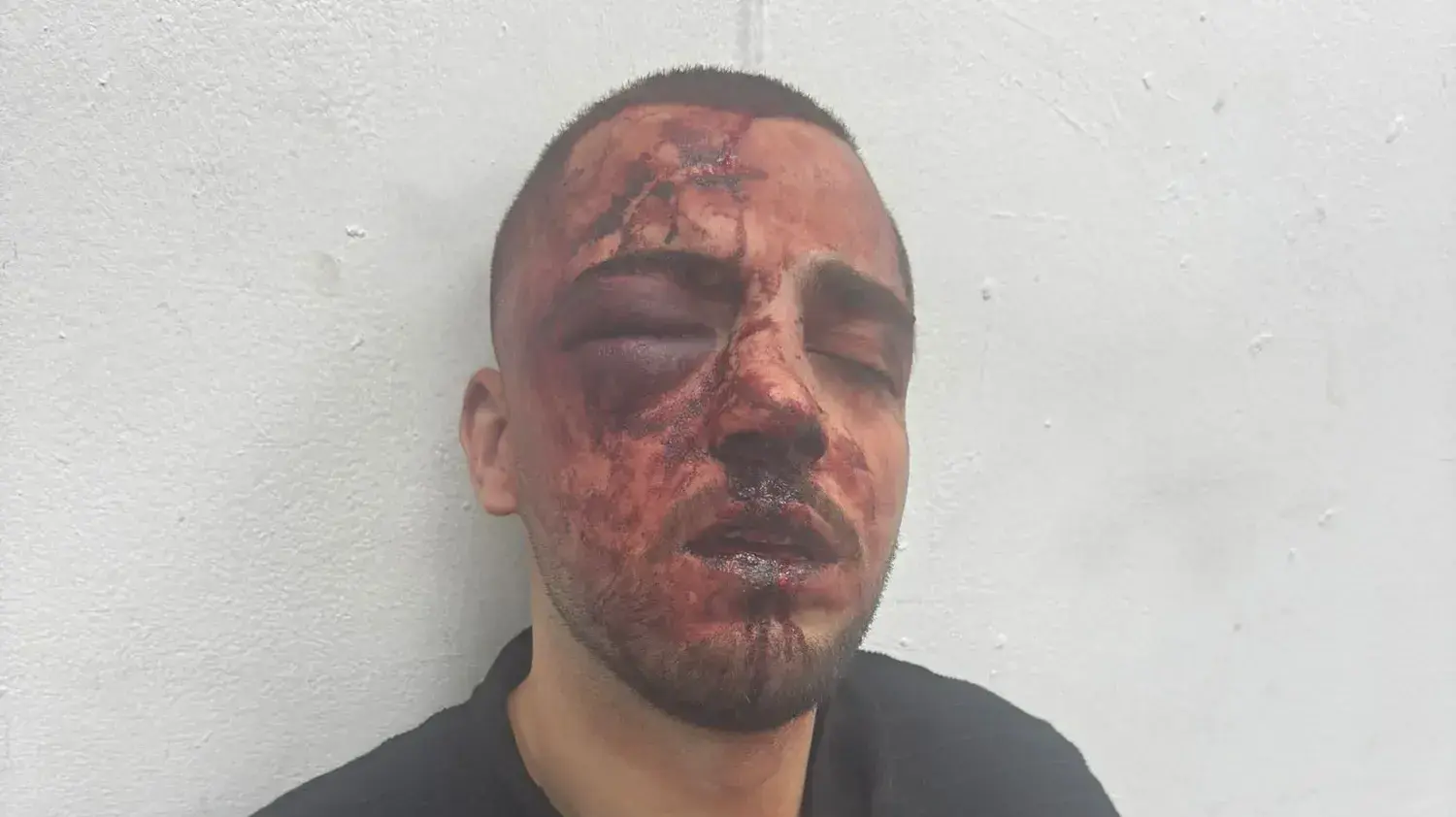 עו"ד סאלח נעמה לאחר מעצרו האלים