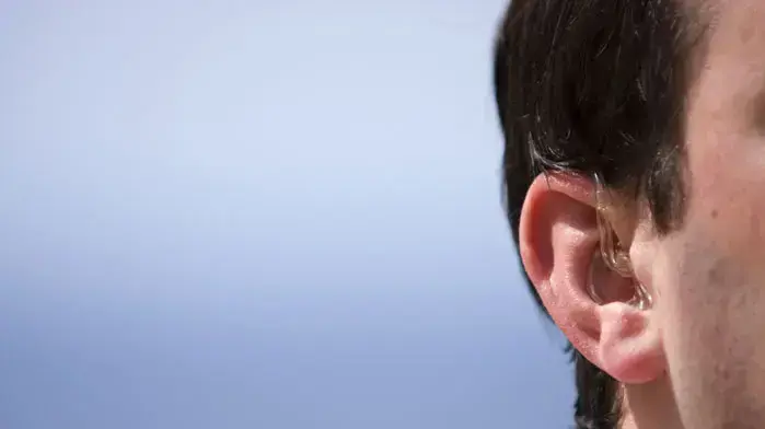 אילוסטרציה