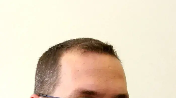 אודי הירש