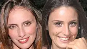 הופרדו בלידתן הופרדו בלידתן