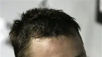 מארק בהרלי שחקן שיקגו וייט סוקס