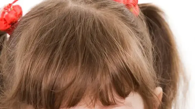 אילוסטרציה