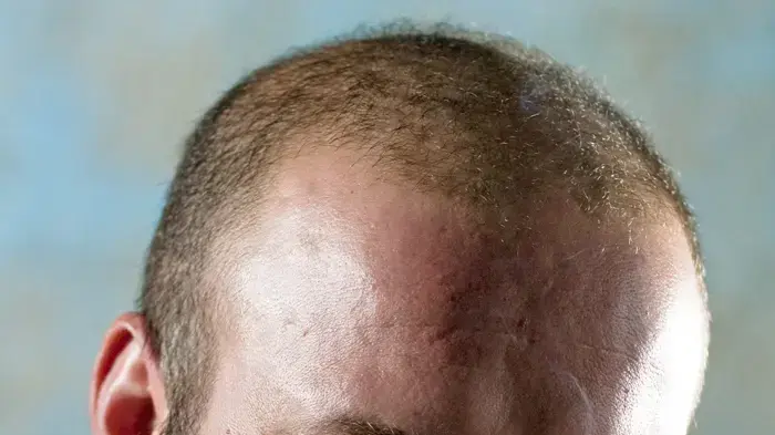 איתי בלטר