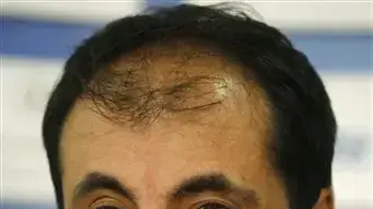 אנדרו אנדרוניקו, מפרק פורטסמות