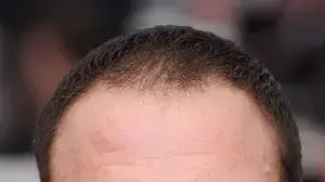 ז'אן קלוד ואן דאם