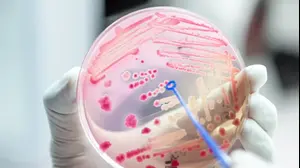 צלחת פטרי עם חיידקים