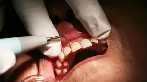 אילוסטרציה