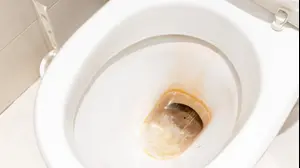 שירותים עם הצטברות אבנית