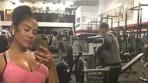 לסלי לוקס לפני הניתוחים