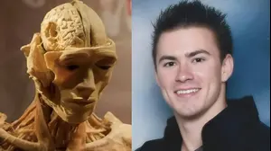 כריס טוד אריק והגופה בתערוכה