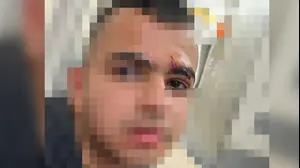 בנה של ל' לאחר התקיפה בקו 27