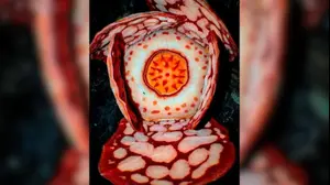 הפרח הנדיר Rafflesia hasseltii באינדונזיה