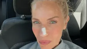 שרון פרי חושפת שאובחנה בסרטן העור