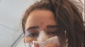 נטלי דדון בפנים חבושות