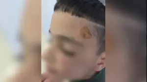 פציעות של ילד מגן יסמין, קרית ביאליק