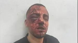 עו"ד סאלח נעמה לאחר מעצרו האלים