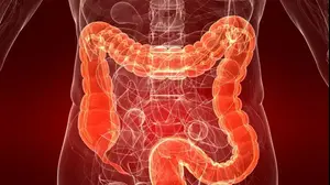 אילוסטרציה