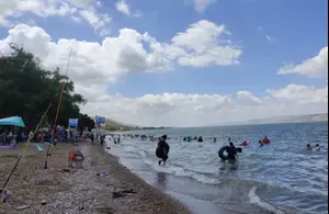 "הוא אמר שמשהו לא בסדר בעין": צעיר לקה בדלקת בקרנית בגלל טפיל בכנרת