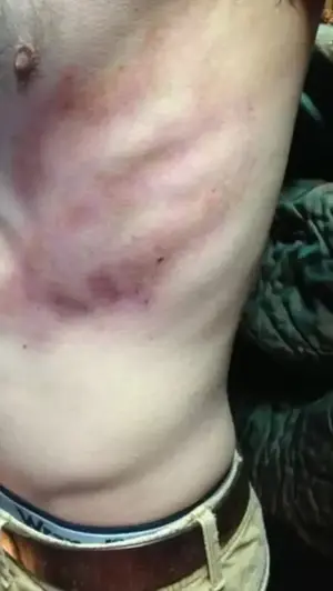 "אגיע אלייך הביתה וארצח אותך": צעיר טוען לאלימות קשה ואיומי רצח בידי שוטר בתא מעצר